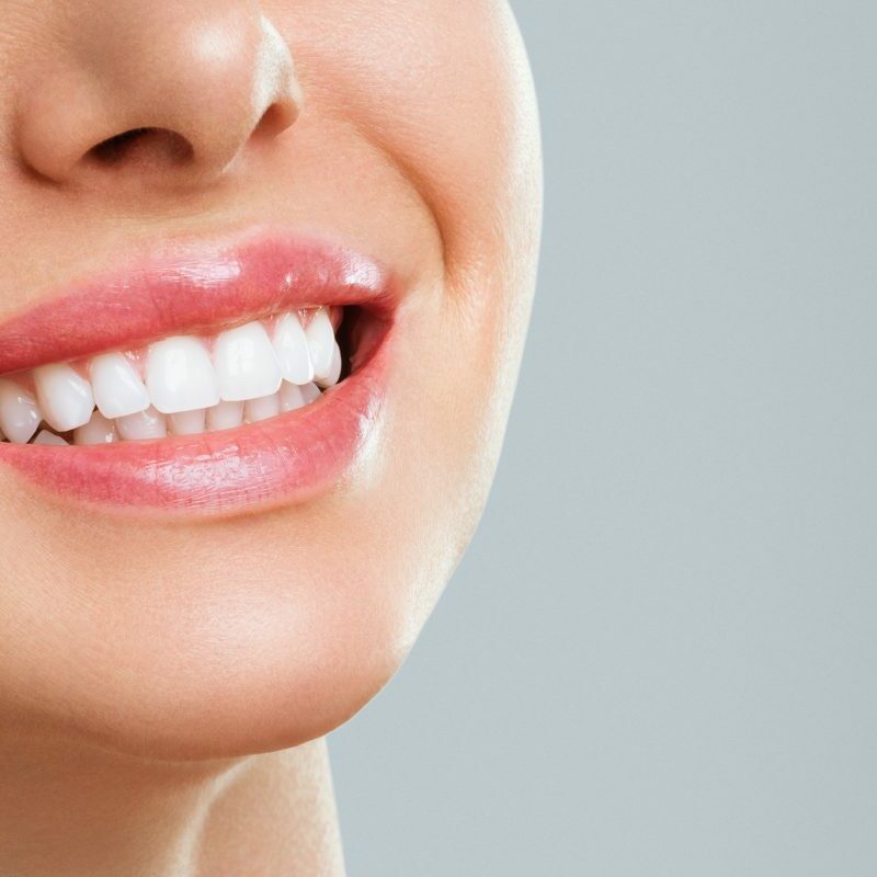 Sourire